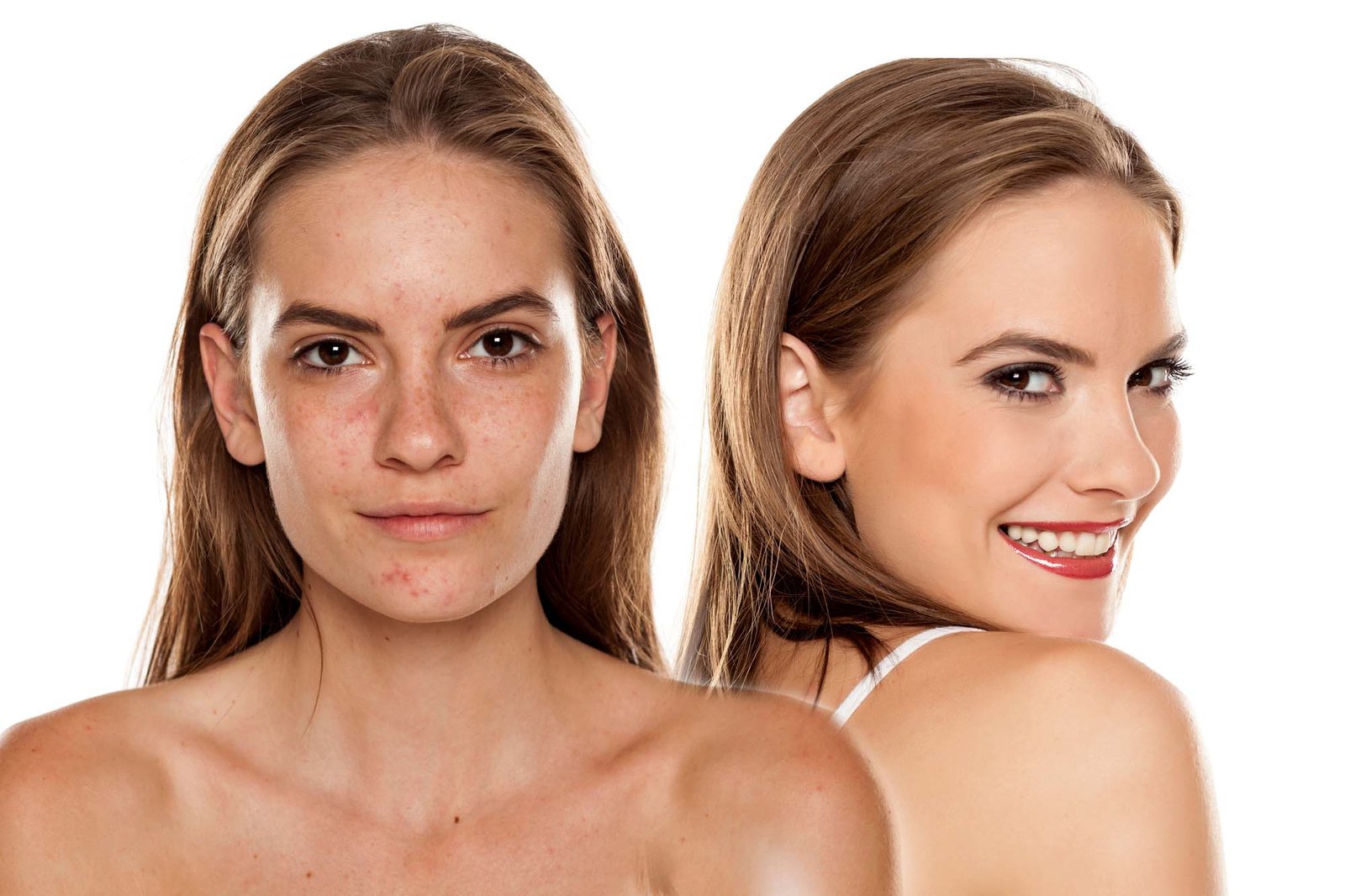 Comparison portrait of young beautiful woman before and after skin treatment and makeup on white backgeound