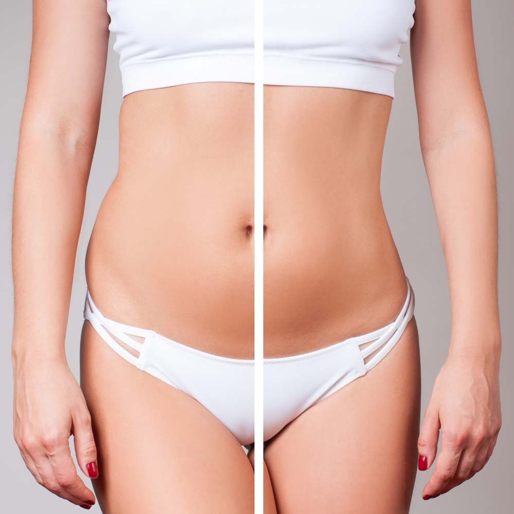 Slim Body Care, BEFORE & AFTER